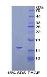 Rat PDGF-AA Protein (Recombinant His-T7)