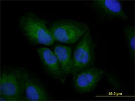 Vimentin Antibody (clone 3E9)