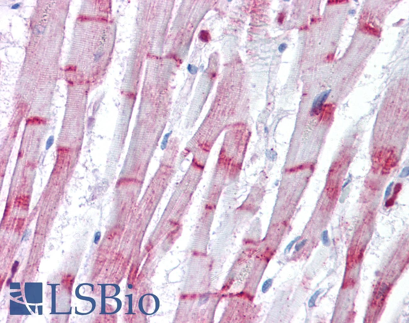 IHC-plus™ ACTN2 Antibody