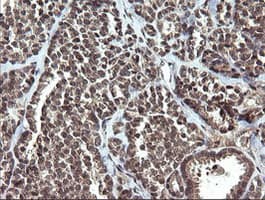 ETS2 Antibody (clone OTI1H4)