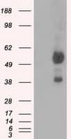 Monoclonal Mouse anti-Human NPR3 Antibody (clone OTI11H6, IHC, IF, WB)
