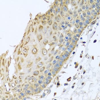 ARFGAP3 Antibody (AP)