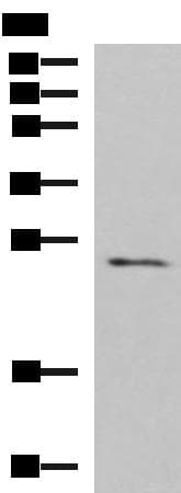 CLEC4D / MCL Antibody