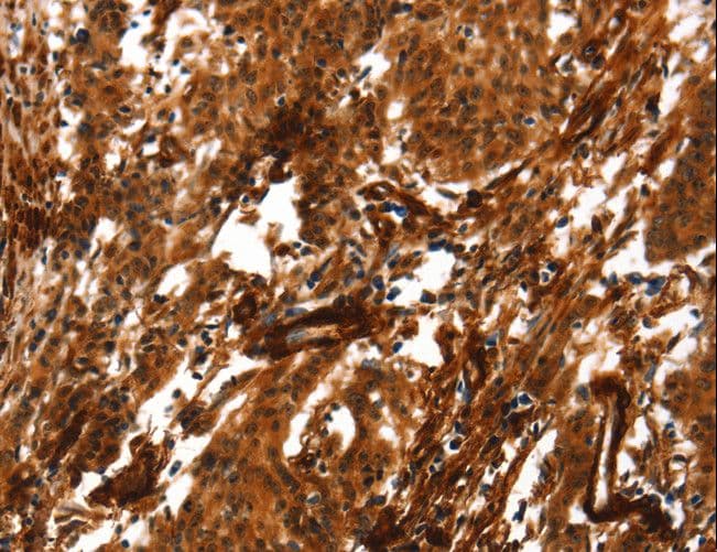 ACTA2 / Smooth Muscle Actin Antibody