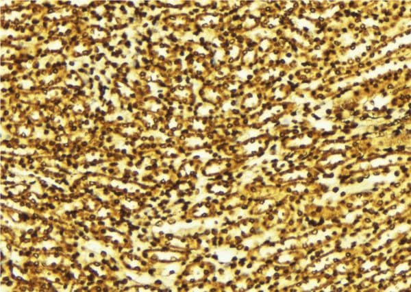 RPS6KB1 / P70S6K / S6K Antibody