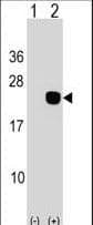 Polyclonal Rabbit anti-Human DCTD / dCMP Deaminase Antibody (aa1-30, WB)