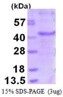 Human MAGEA6 Protein (Recombinant His)