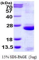 Human UPK3A / UPK3 / Uroplakin III Protein (Recombinant His)