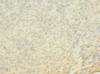 FRS3 Antibody