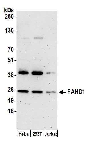 Polyclonal Rabbit anti-Human FAHD1 Antibody (aa174-224, WB)