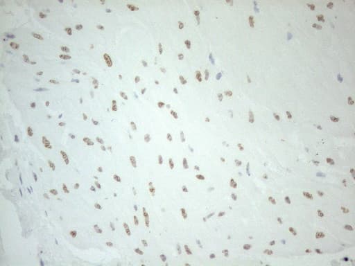 PELI1 / Pellino 1 Antibody (aa1-245, clone OTI13F8)