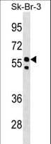 FBXO31 Antibody (aa310-338)