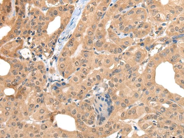 CA7 / Carbonic Anhydrase VII Antibody