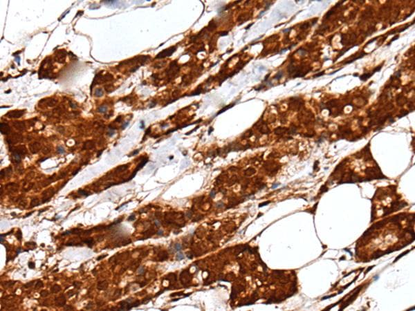 UEV1 / UEV1A Antibody