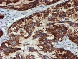 PPAT Antibody (aa42-278, clone OTI1B8)