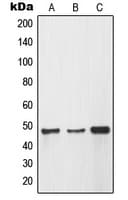 MMP12 Antibody (Internal)