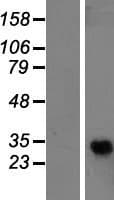 ADGRF1 / GPR110 Protein (Over-Expression Lysate Myc-DDK (Flag))