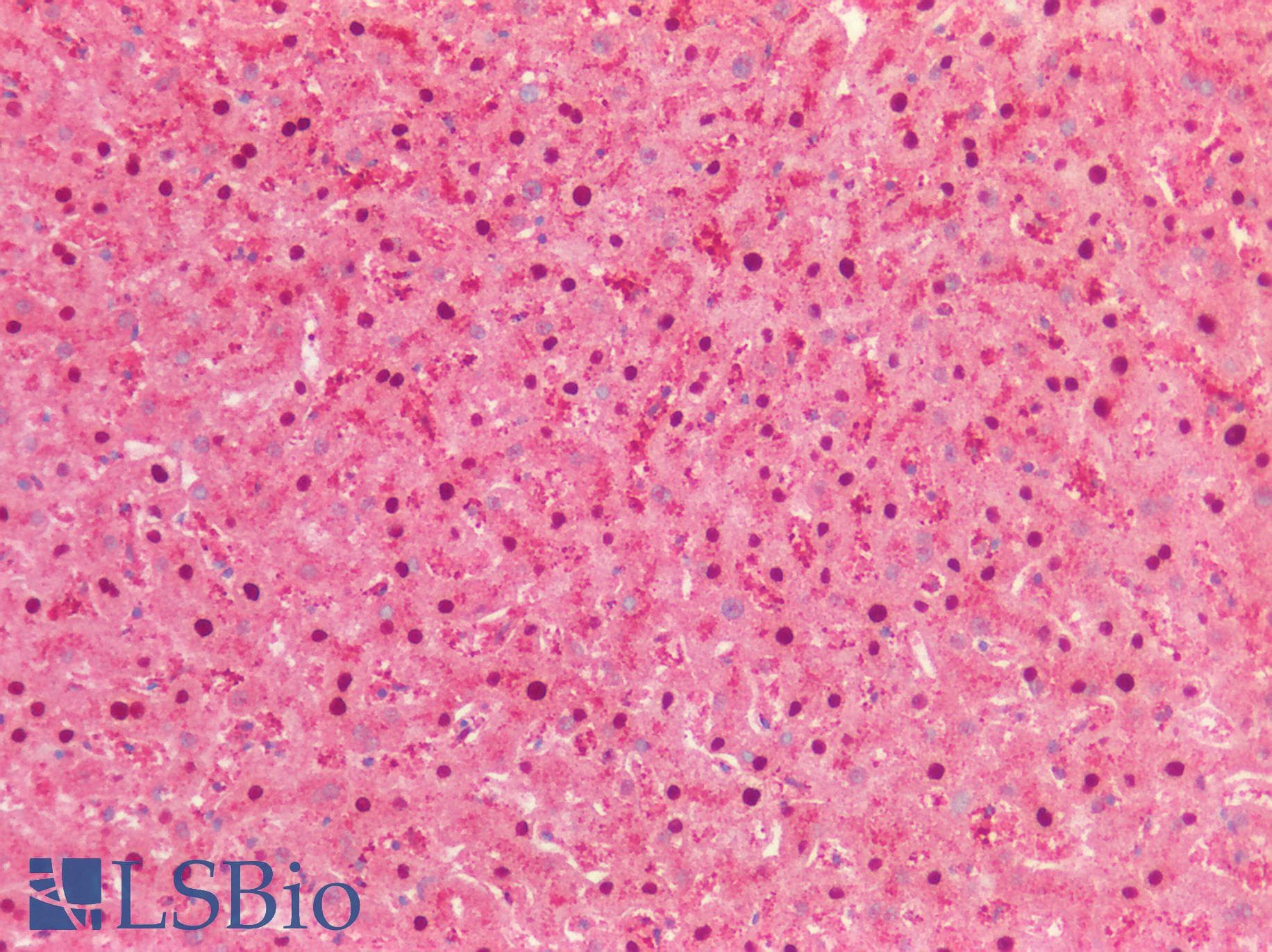 PathPlus™ Polyclonal Rabbit anti-Human APBA3 / MINT3 Antibody (aa352-401, IHC, WB)