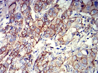 Monoclonal Mouse anti-Human ALCAM / CD166 Antibody (clone 3D9F1, IHC, WB)