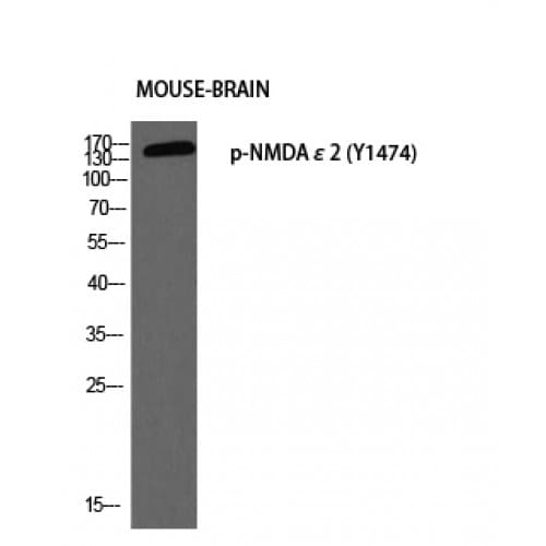 Polyclonal Rabbit anti-Human GRIN2B / NMDAR2B / NR2B Antibody (1410-1490 aa, IHC, WB)