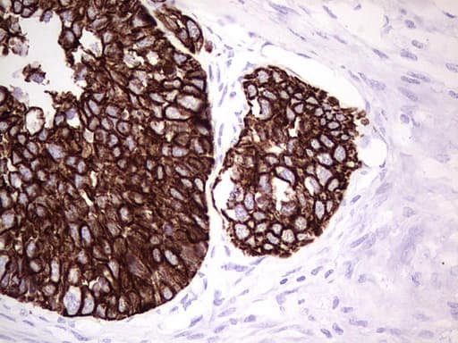 KRT19 / CK19 / Cytokeratin 19 Antibody (aa240-390, clone UMAB186, Carrier-free)