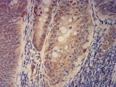 KAT2B / PCAF Antibody (clone 7D12C8)