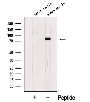 LDB3 / ZASP Antibody