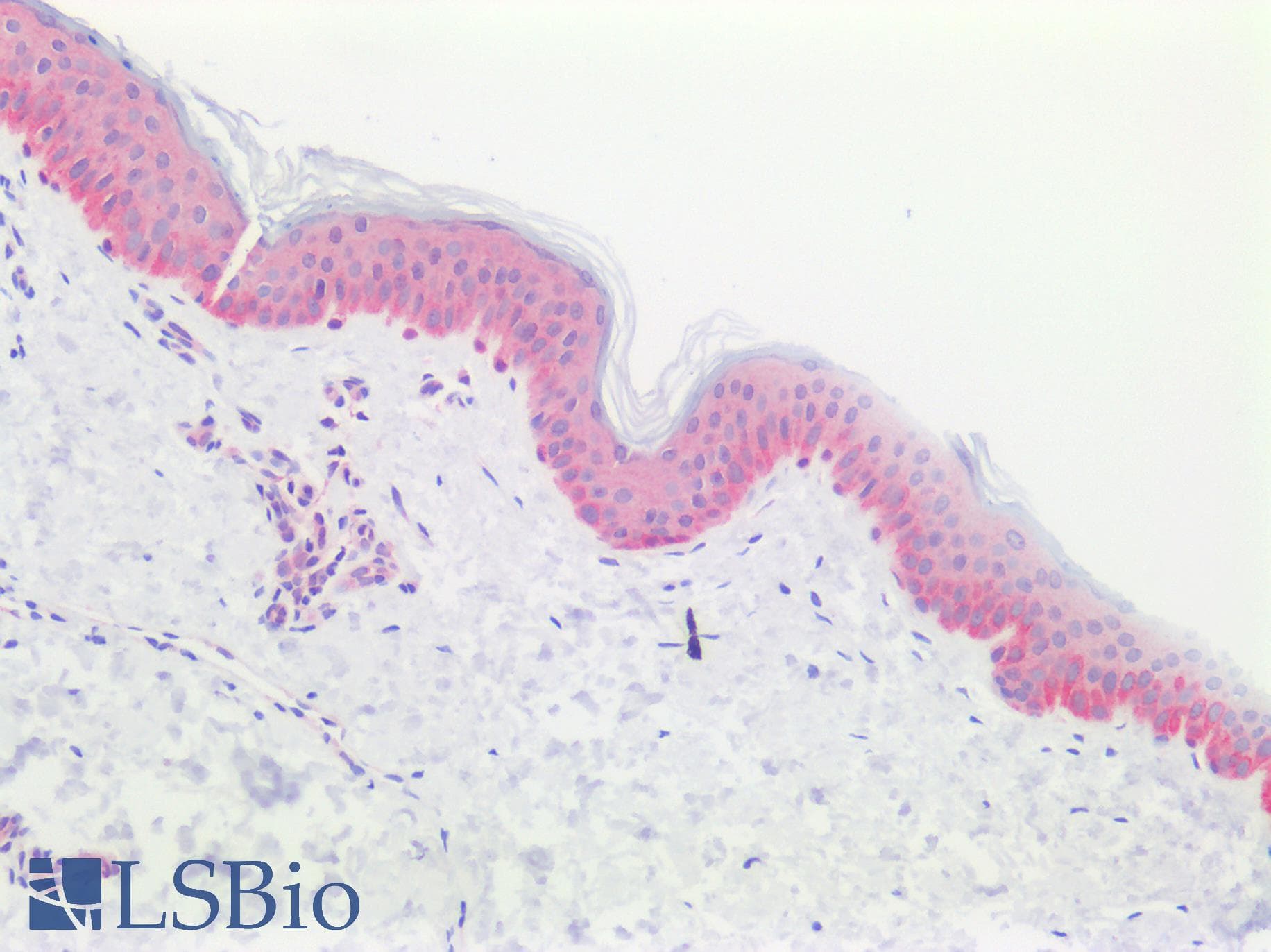 IHC-plus™ Polyclonal Rabbit anti-Human PVRL4 / Nectin 4 Antibody (aa371-510, IHC, WB)