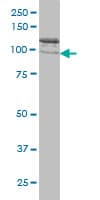 CLCN2 Antibody (clone 3E1)