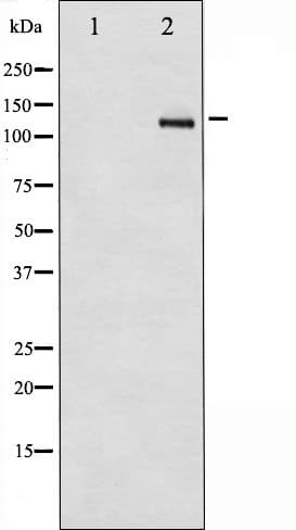 Polyclonal Rabbit anti-Human PDGFRB / PDGFR Beta Antibody (WB)
