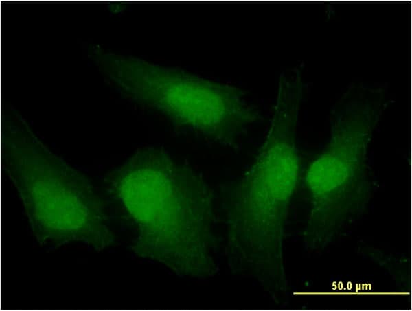 Monoclonal Mouse anti-Human IRF3 Antibody (clone 3C8, IF, WB)