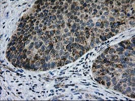 CCM2 / Malcavernin Antibody (clone OTI1E9)