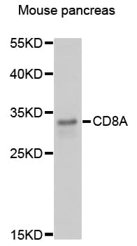 Polyclonal Rabbit anti-Human CD8A / CD8 Alpha Antibody (IHC, WB)