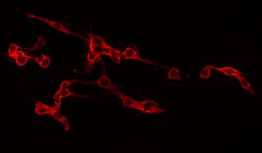 SLC2A3 / GLUT3 Antibody