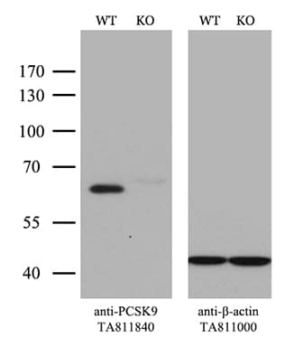 PCSK9 Antibody (aa153-692, clone OTI8E10)