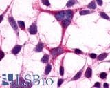 PathPlus™ GRM3 / MGLUR3 Antibody (N-Terminus)