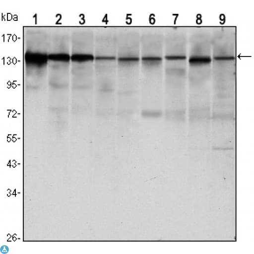 CDH1 / E Cadherin Antibody