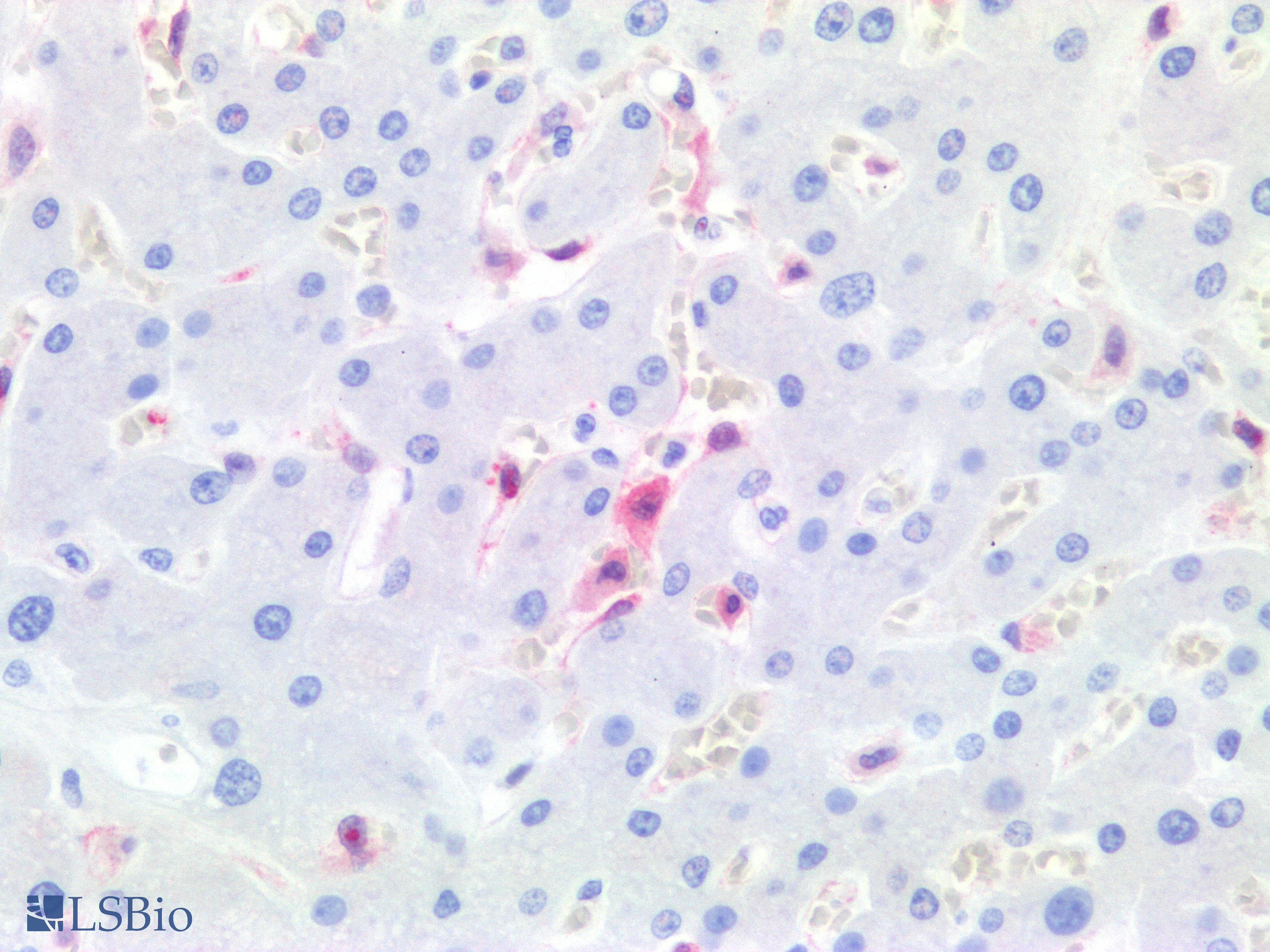 PathPlus™ FSCN1 / Fascin Antibody