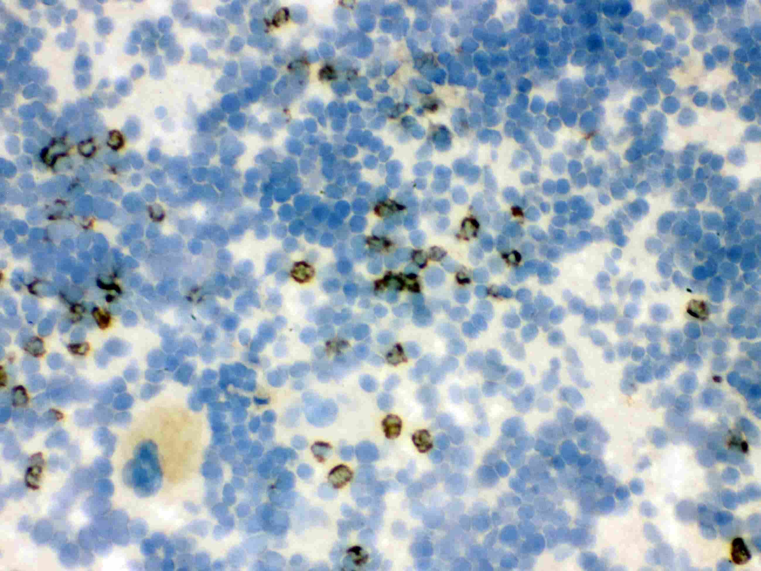 LCN2 / Lipocalin 2 / NGAL Antibody (aa21-200)