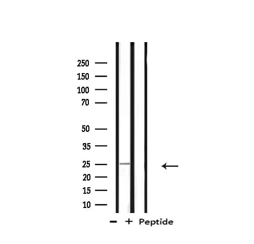 Polyclonal Rabbit anti-Human RPL10 / Ribosomal Protein L10 Antibody (IF, WB)