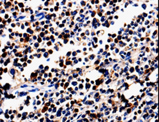 Polyclonal Rabbit anti-Human ALOX5 / 5-LOX Antibody (IHC)