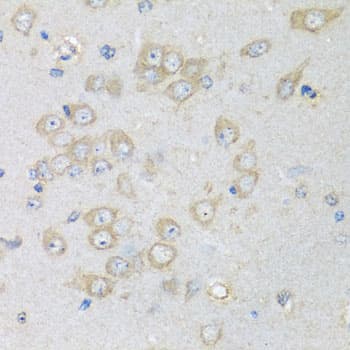 CHMP1B Antibody