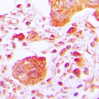 PLCG1 Antibody (phospho-Tyr783)