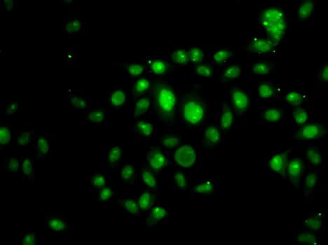 HOXB7 Antibody