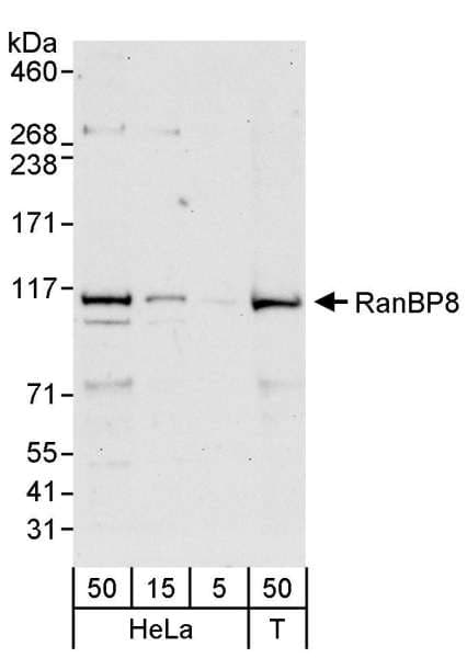 Polyclonal Rabbit anti-Human IPO8 / Importin 8 Antibody (aa987-1037, WB)