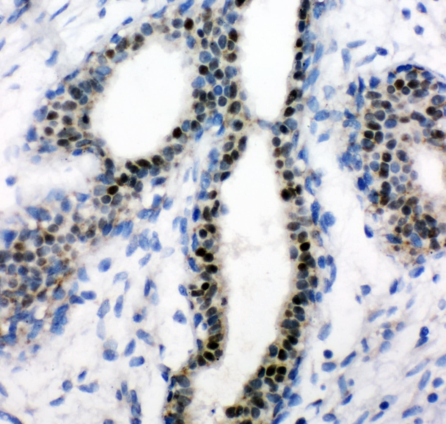 ER Alpha / Estrogen Receptor Antibody (aa425-595)