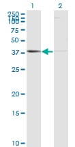 PSMB8 / LMP7 Antibody (clone 1B3)