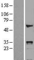 HOXB5 Protein (Over-Expression Lysate Myc-DDK (Flag))