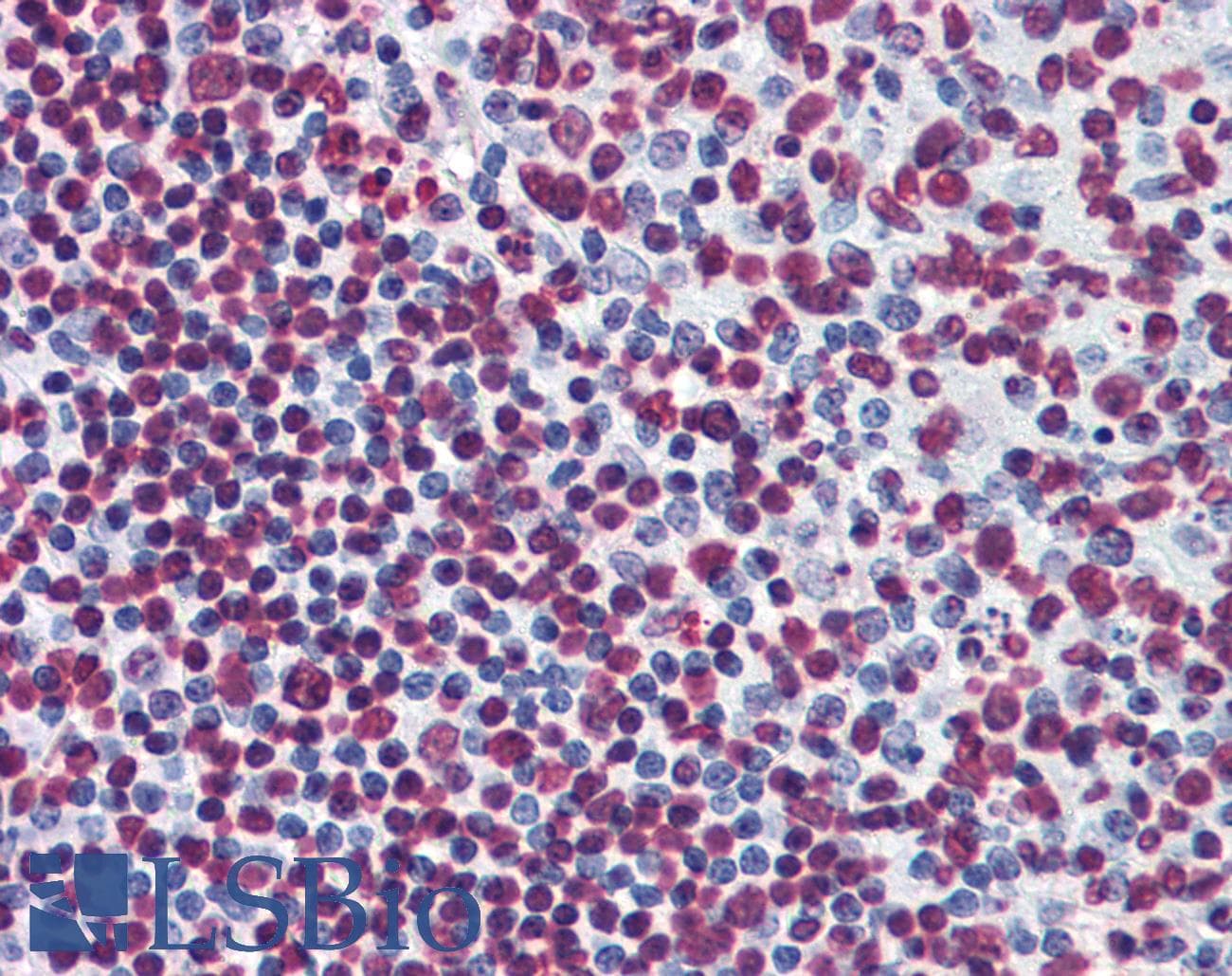 IHC-plus™ BIK Antibody (clone 4G12)