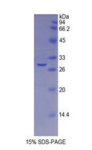 Mouse GLB1 / Beta-Galactosidase Protein (Recombinant His)